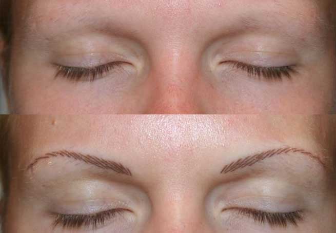 Micropigmentation Before & After