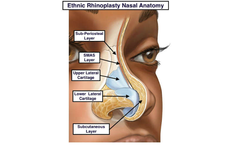 African American Rhinoplasty - Anatomy