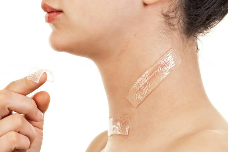Biocorneum – The Advanced Treatment For Your Stubborn Scars